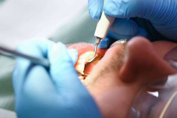 Best Urgent Care for Lost Fillings or Crowns in Belle, WV