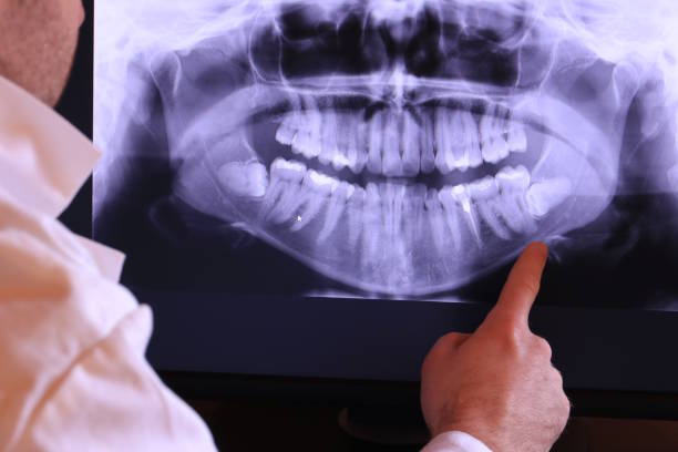 Best Emergency Tooth Extraction in Belle, WV