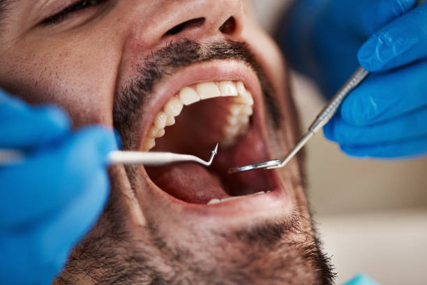 Best Emergency Treatment for Dental Infections or Abscesses in Belle, WV